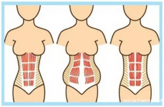 产后腰疼与腹直肌的关系深度解析
